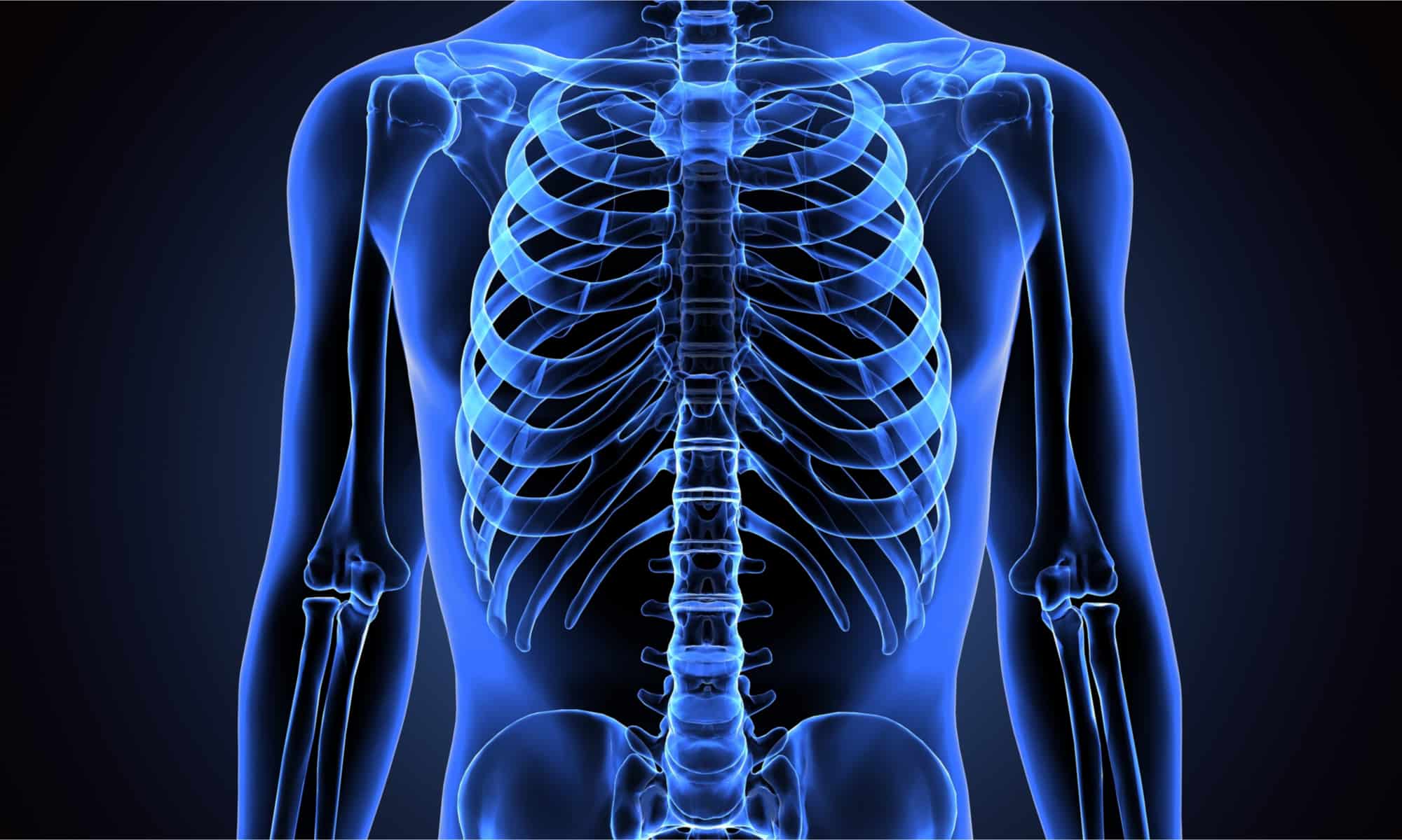 Il più grande calcolo renale mai registrato