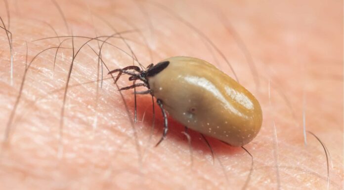 Zecche nel Tennessee
