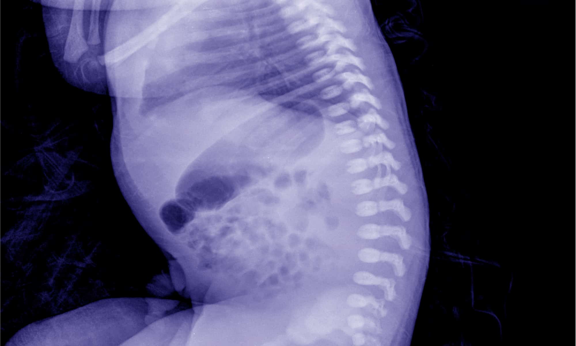 Quante ossa hanno i bambini?