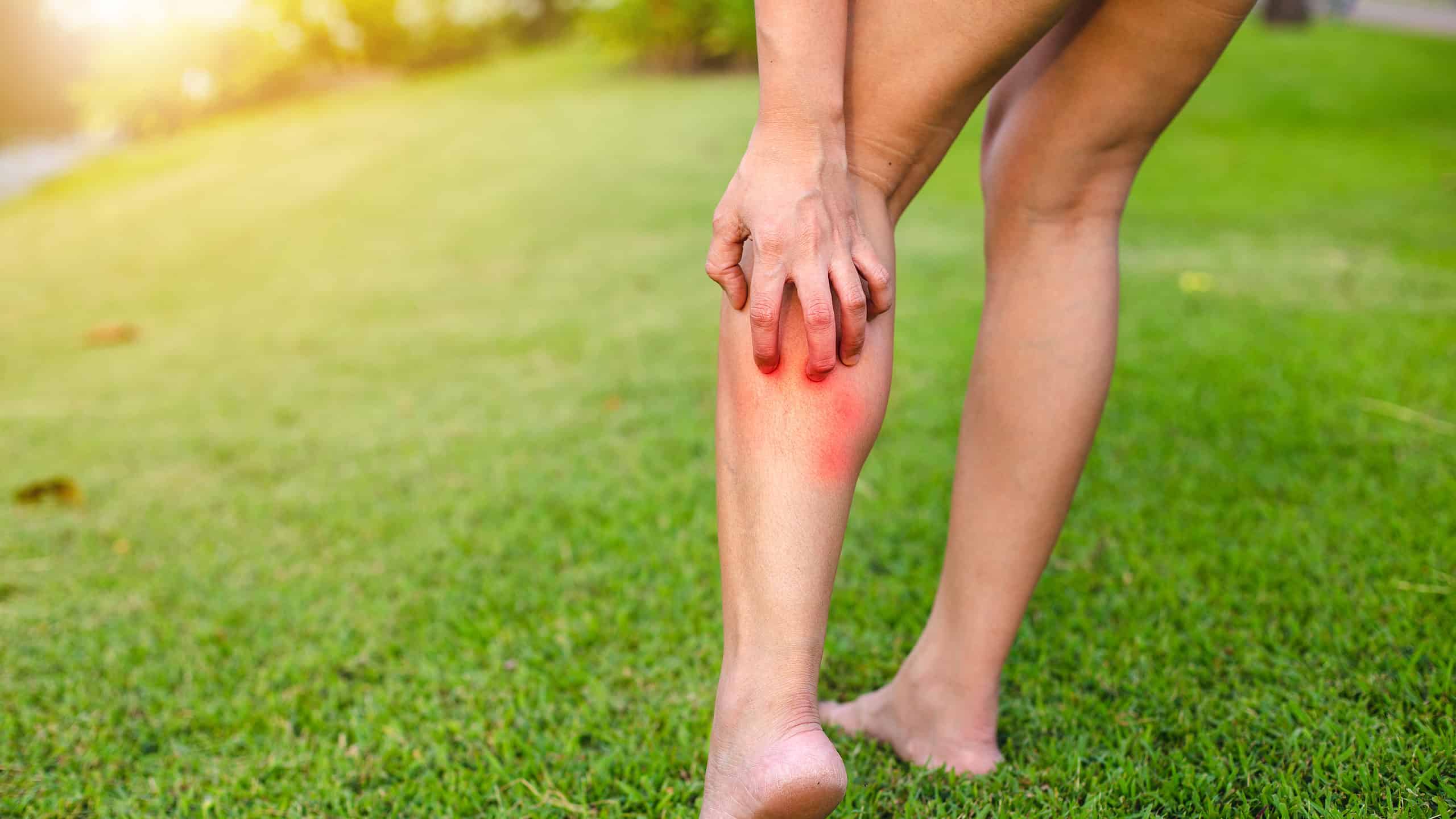 Insetti pungenti: 10 delle punture di insetti più dolorose al mondo