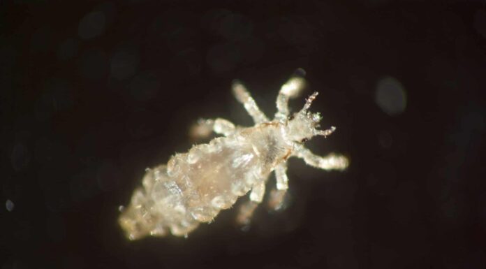  I pidocchi sono neri?  (+ Altre domande con risposta)
