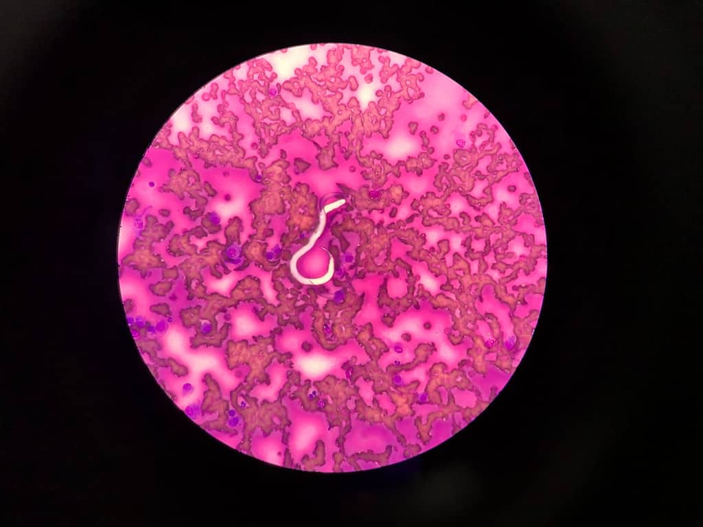 Dirofilaria immitis o filaria in una capsula Petri di sangue di cane.