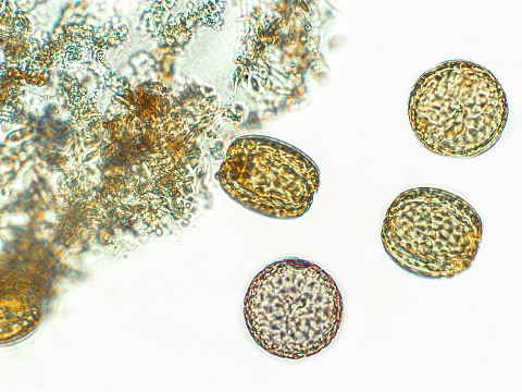Diatomee, alghe al microscopio, fitoplancton, fossili, silice, alghe giallo oro