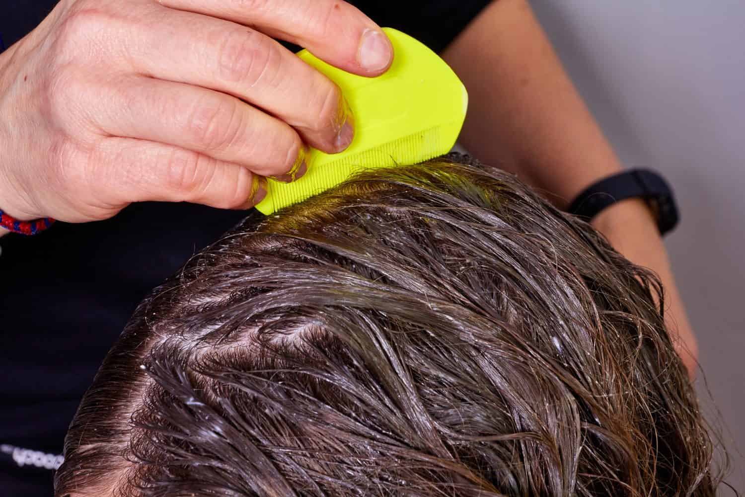 persona che controlla i pidocchi sui capelli bagnati, con un pettine giallo per pidocchi