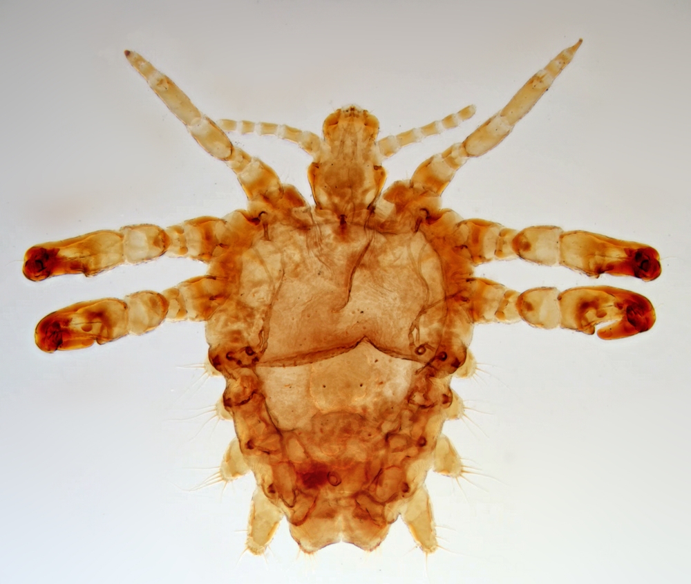 Pidocchio pubico (Pthirus pubis) al microscopio