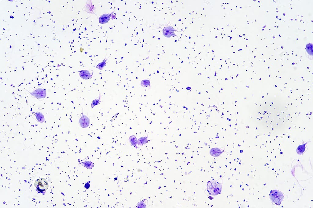 Il parassita protozoario flagellato Giardia intestinalis al microscopio