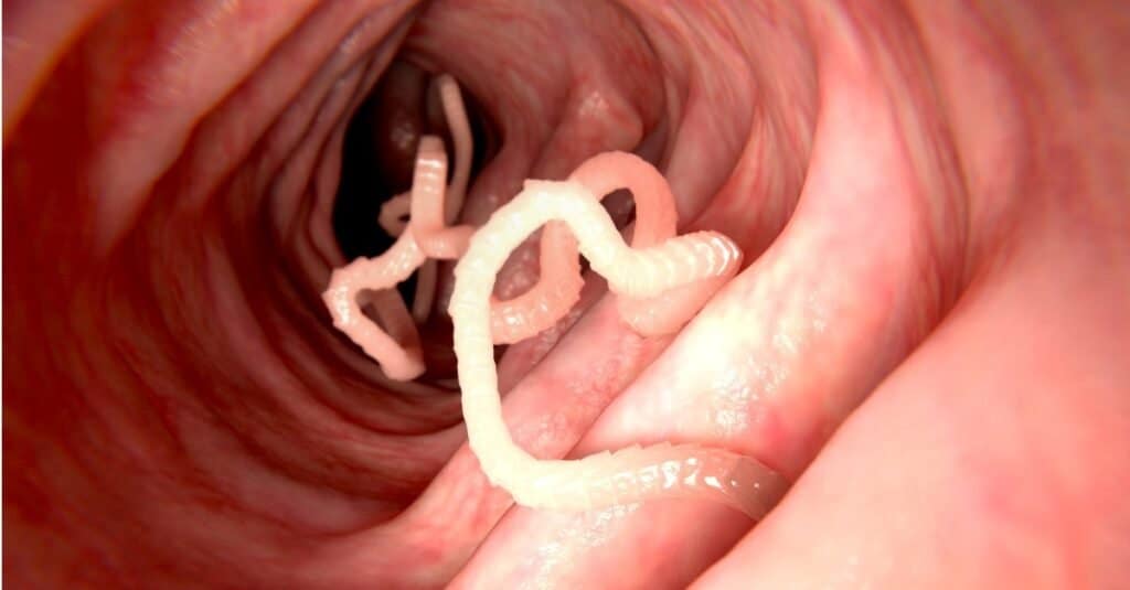 Tenie nell'intestino umano.