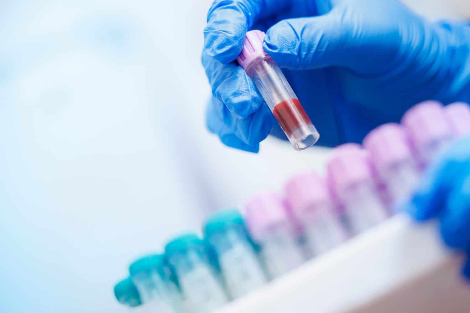 Mani guantate che tengono il campione di sangue presso il laboratorio della clinica veterinaria.